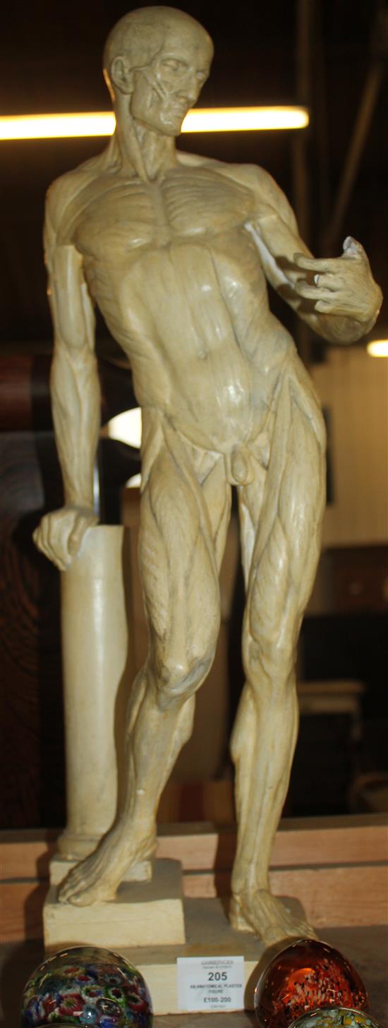 An anatomical plaster figure